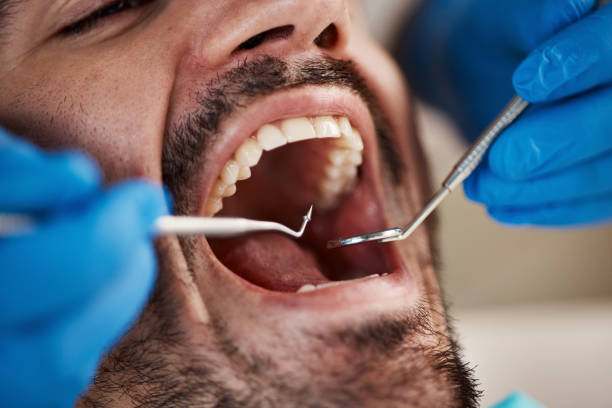 Best Emergency Dental Care for Sports Injuries in Leesburg, GA